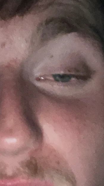 ayylachyy