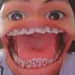 ElJoZepe10