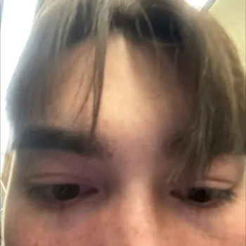 CMIToph