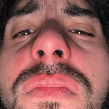 HopyXD