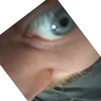 bolzakmartyn