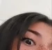 Nix_xenna