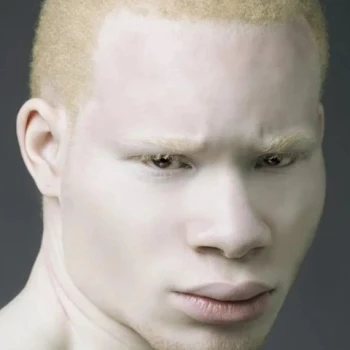 Chekko