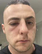 dz_onyy