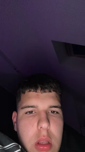 BartoxG2