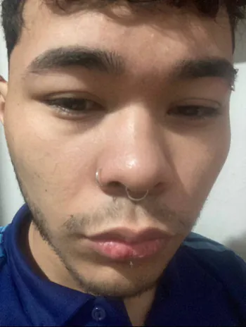 bychoz1