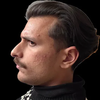 FreddieRage