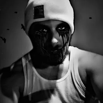 NxN_Skabzz
