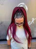 Shalynka